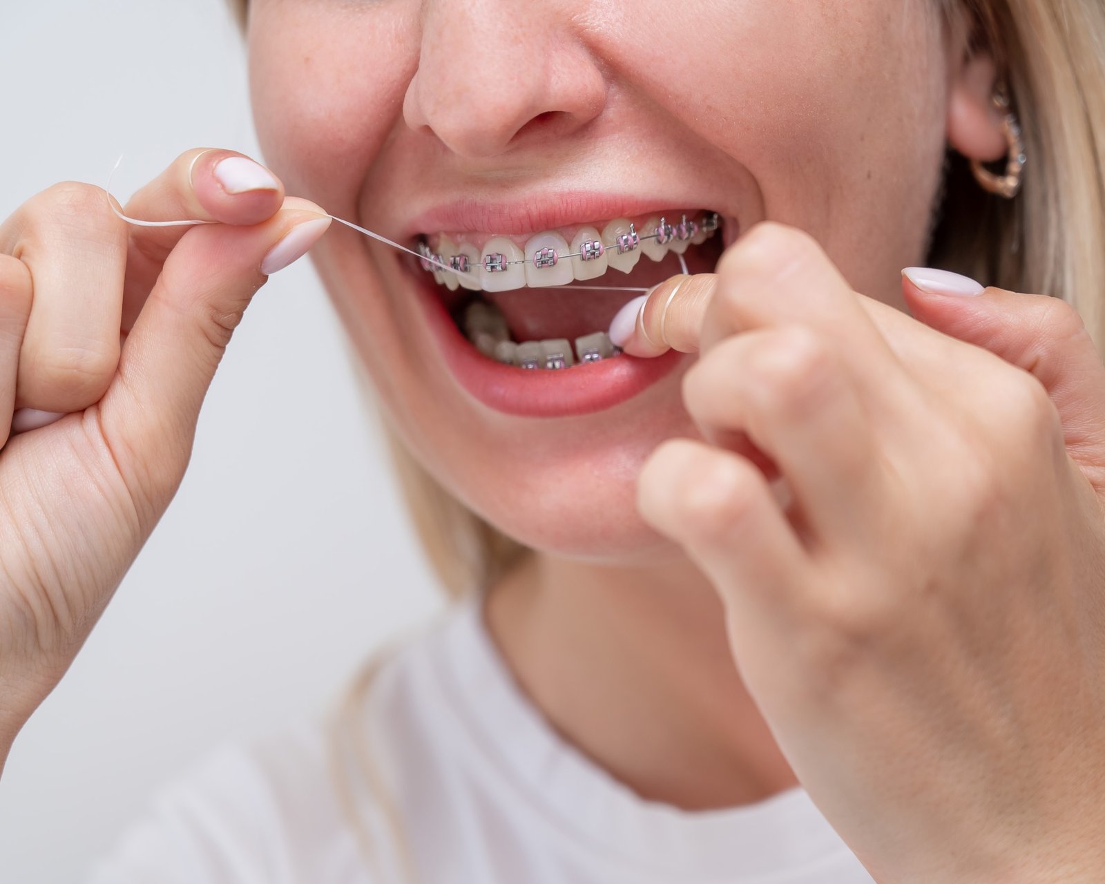 Flossing with braces