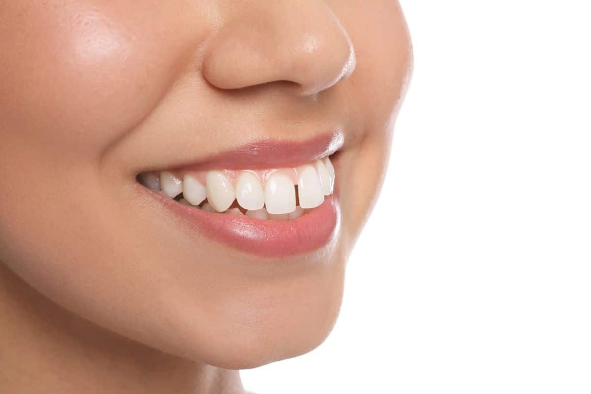 Teeth Protrusion