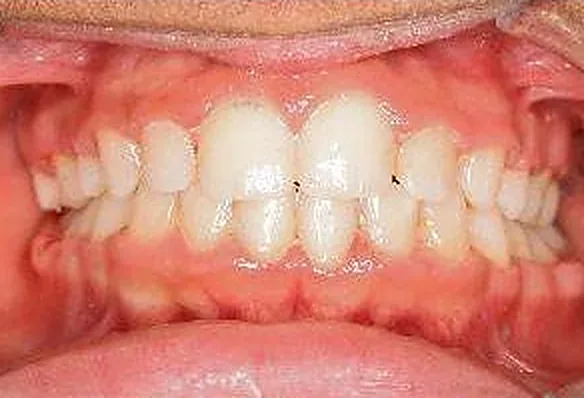 Case 2 result