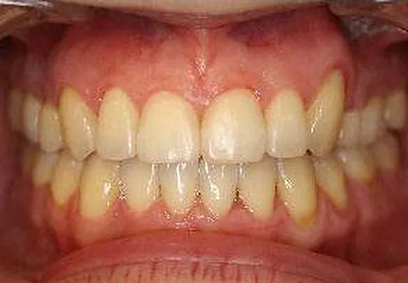 Case 3 result