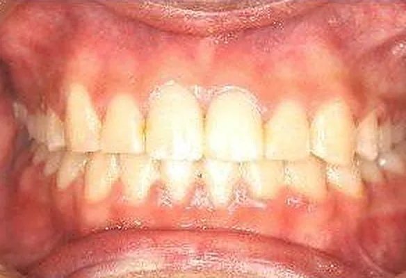 Case 5 result