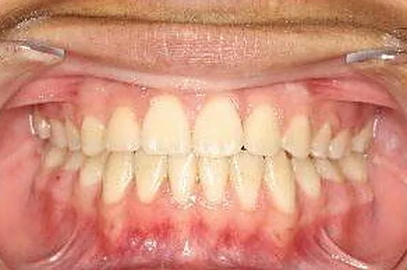 Case 6 result
