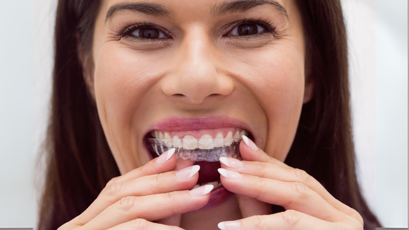 Are braces faster than Invisalign